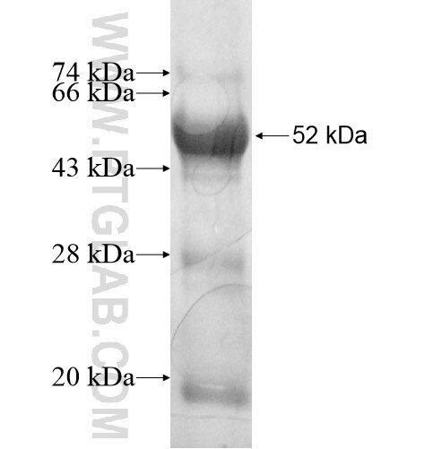 RSPH3 fusion protein Ag11958 SDS-PAGE