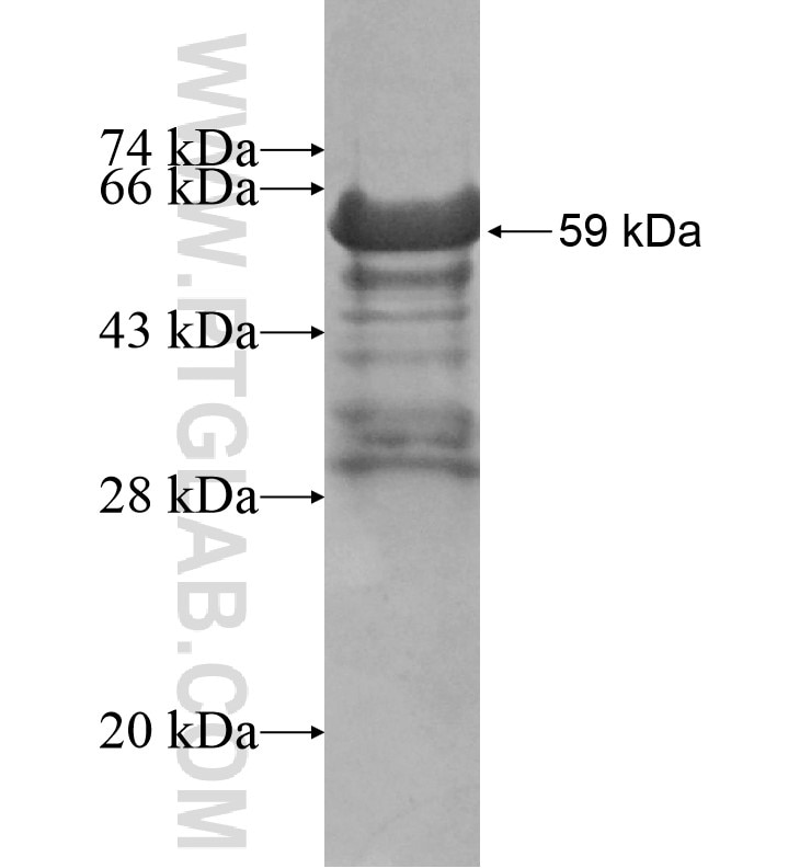 RSPH4A fusion protein Ag16551 SDS-PAGE