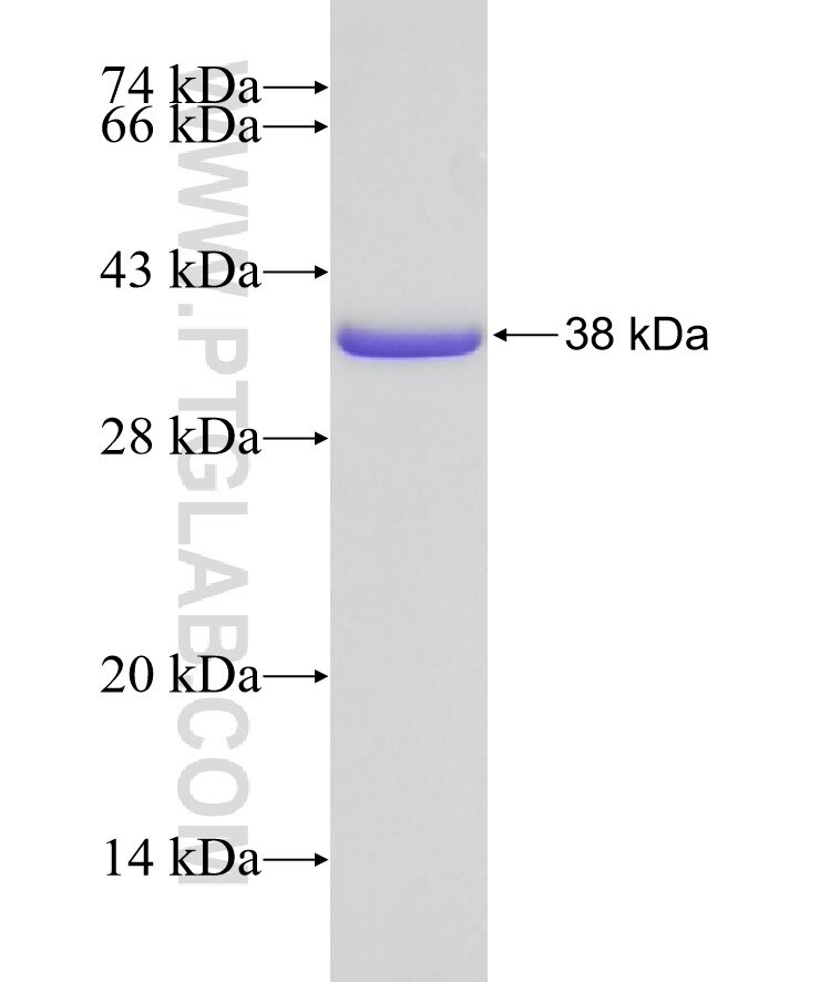 RSPH4A fusion protein Ag16553 SDS-PAGE