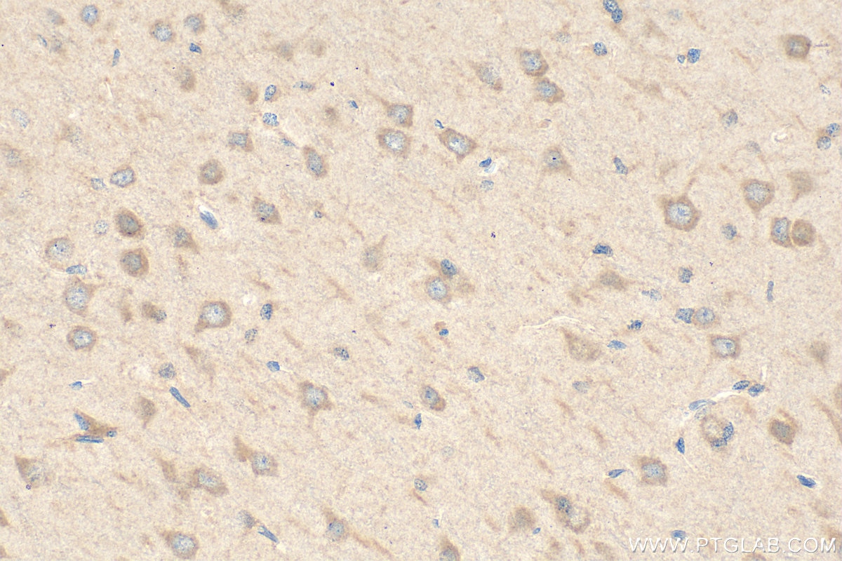Immunohistochemistry (IHC) staining of rat brain tissue using RSPH9 Polyclonal antibody (23253-1-AP)