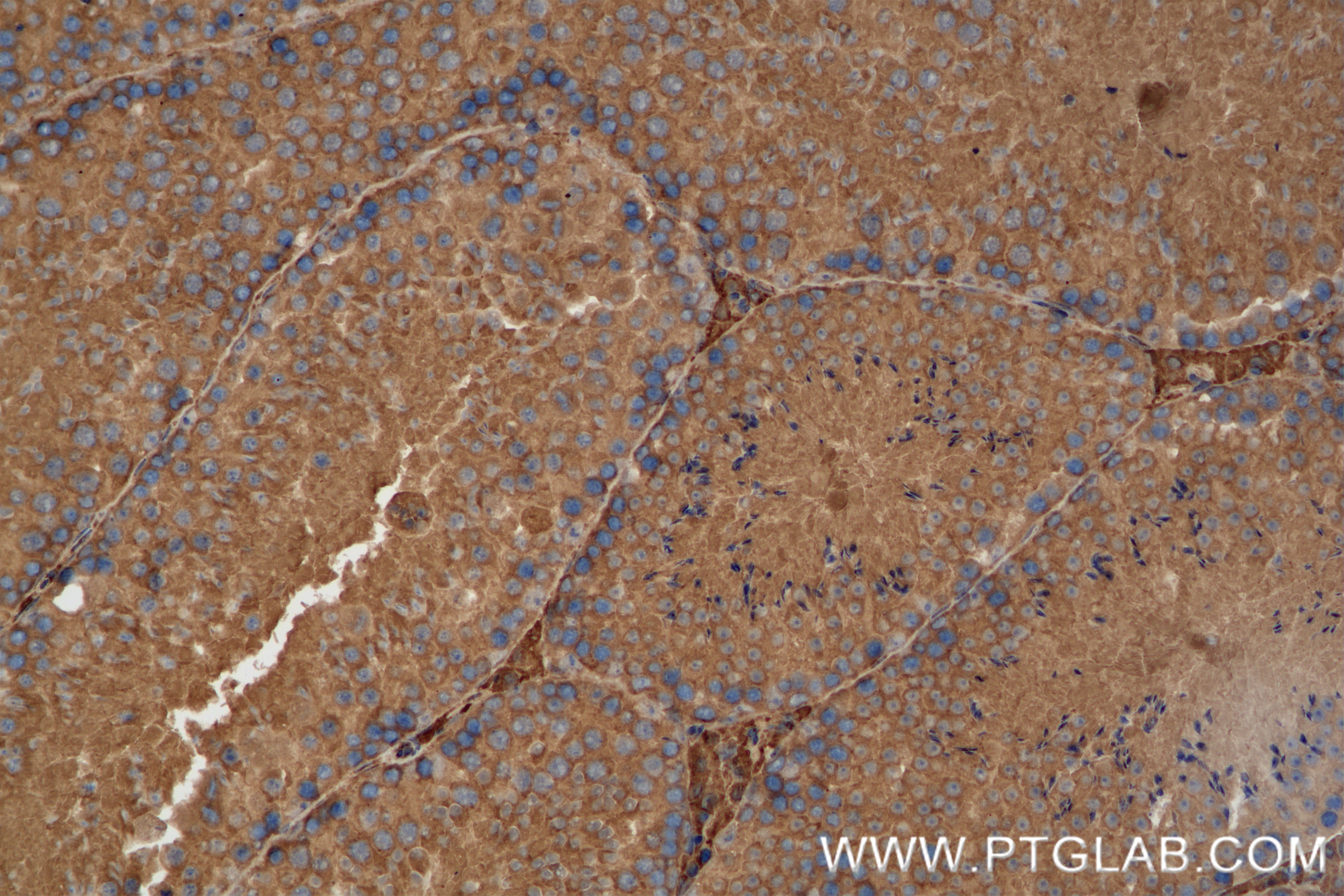 Immunohistochemistry (IHC) staining of mouse testis tissue using RSPH9 Recombinant antibody (85026-4-RR)