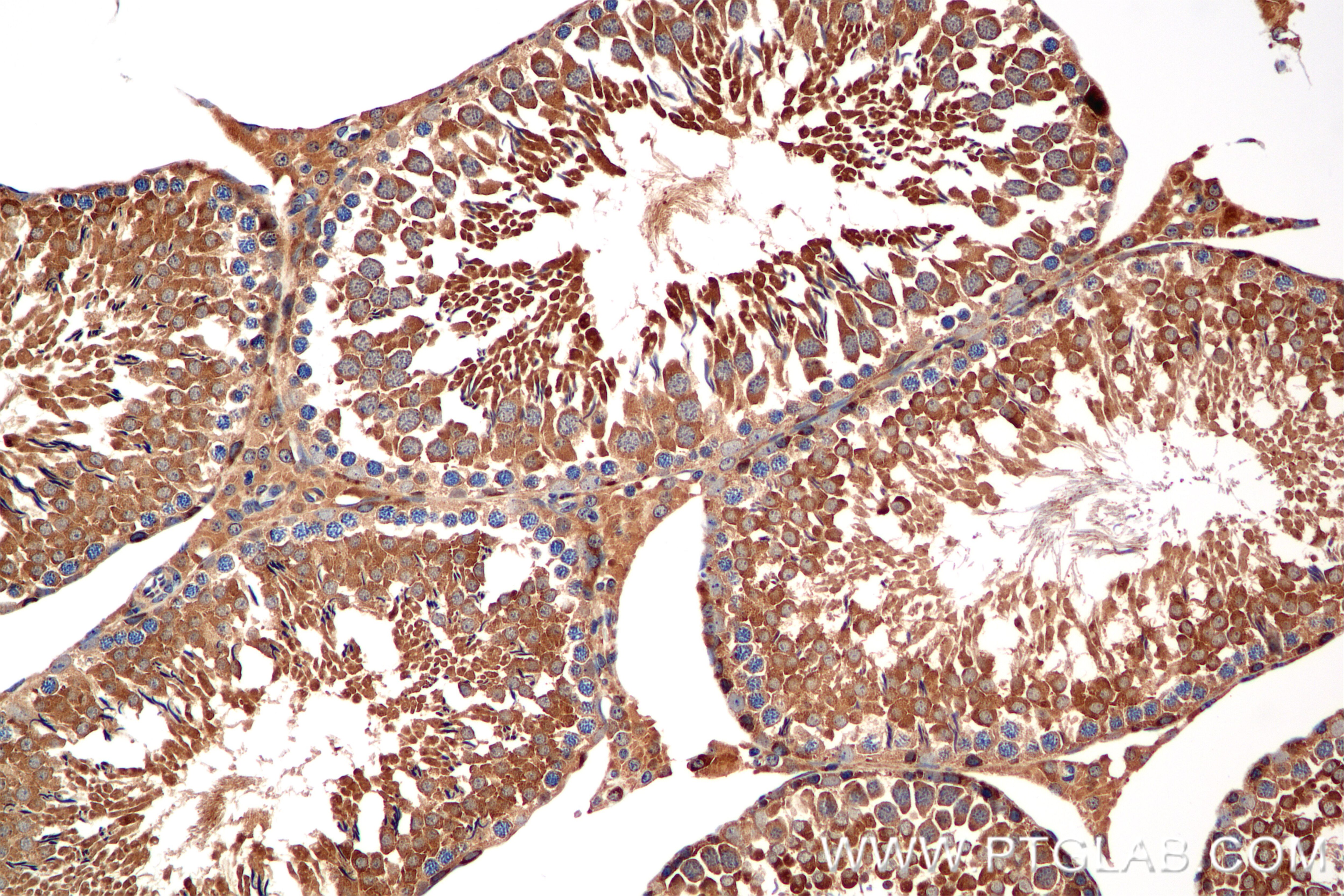 Immunohistochemistry (IHC) staining of rat testis tissue using RSPH9 Recombinant antibody (85026-4-RR)