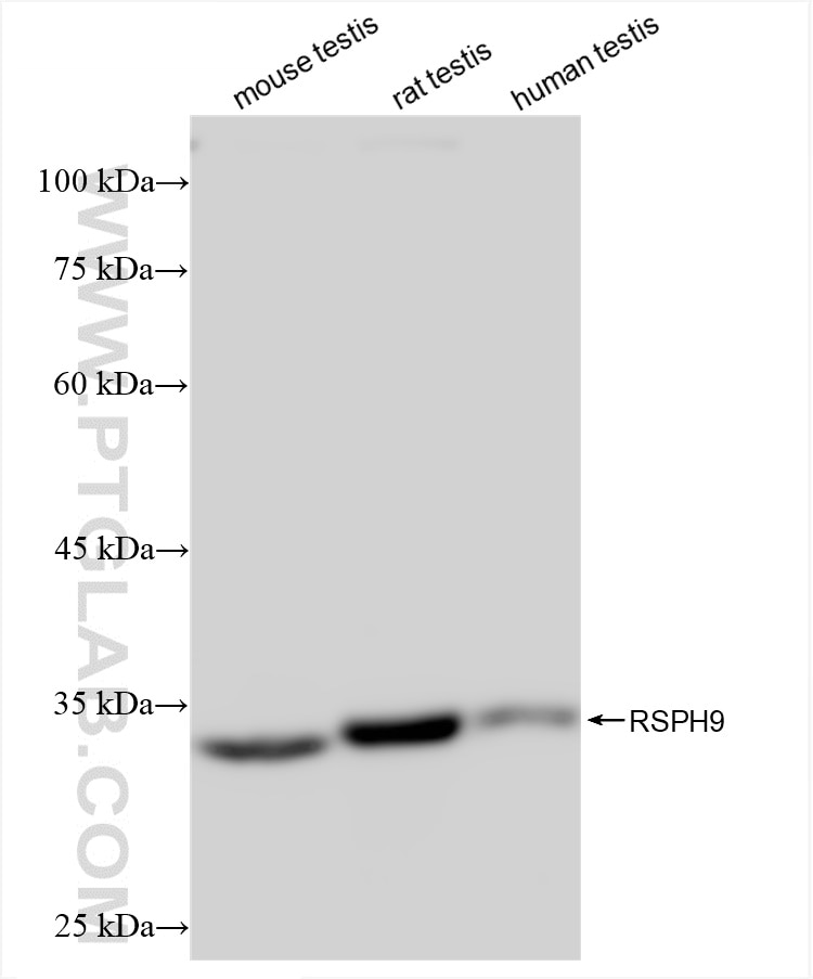 RSPH9