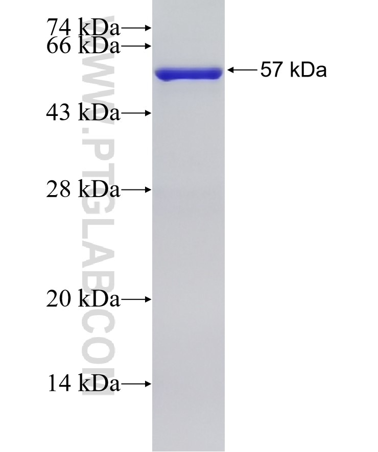 RSPH9 fusion protein Ag19745 SDS-PAGE