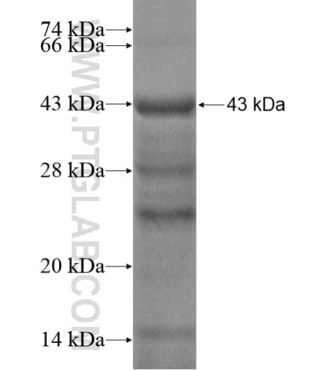 RSPH9 fusion protein Ag19752 SDS-PAGE