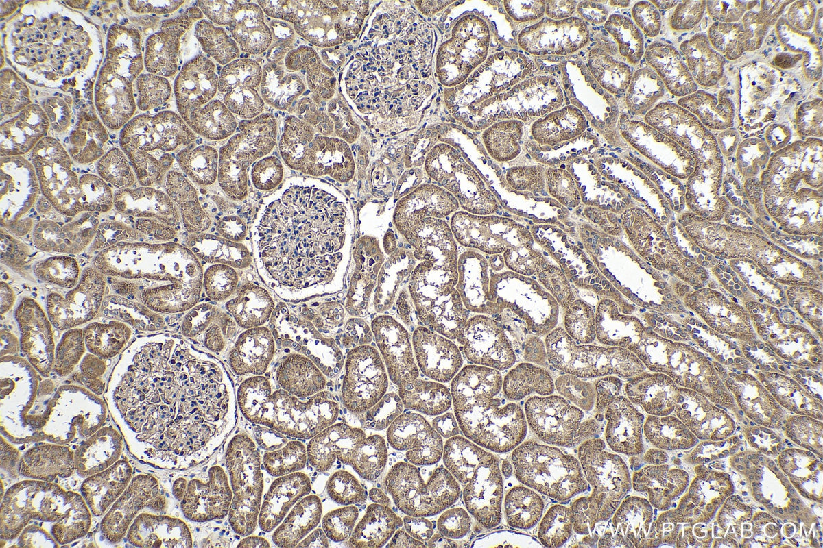 IHC staining of human kidney using 25348-1-AP