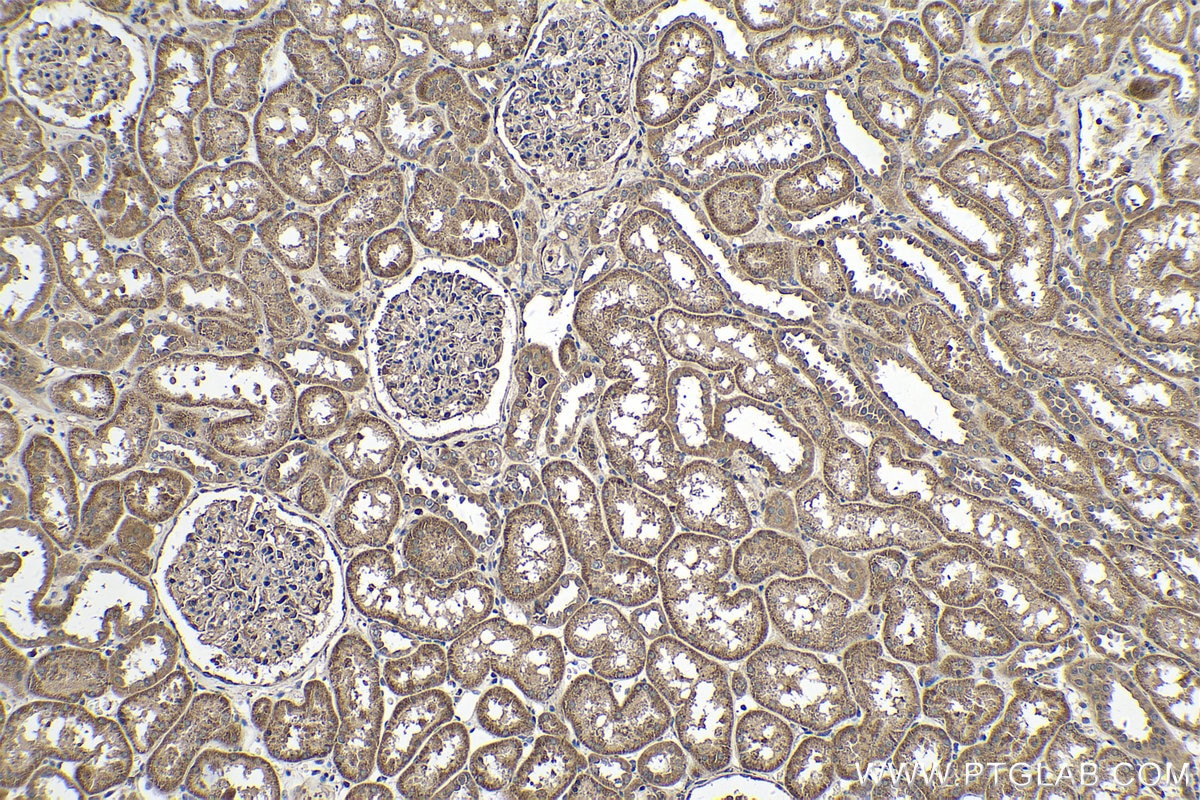 Immunohistochemistry (IHC) staining of human kidney tissue using RSPO1 Polyclonal antibody (25348-1-AP)