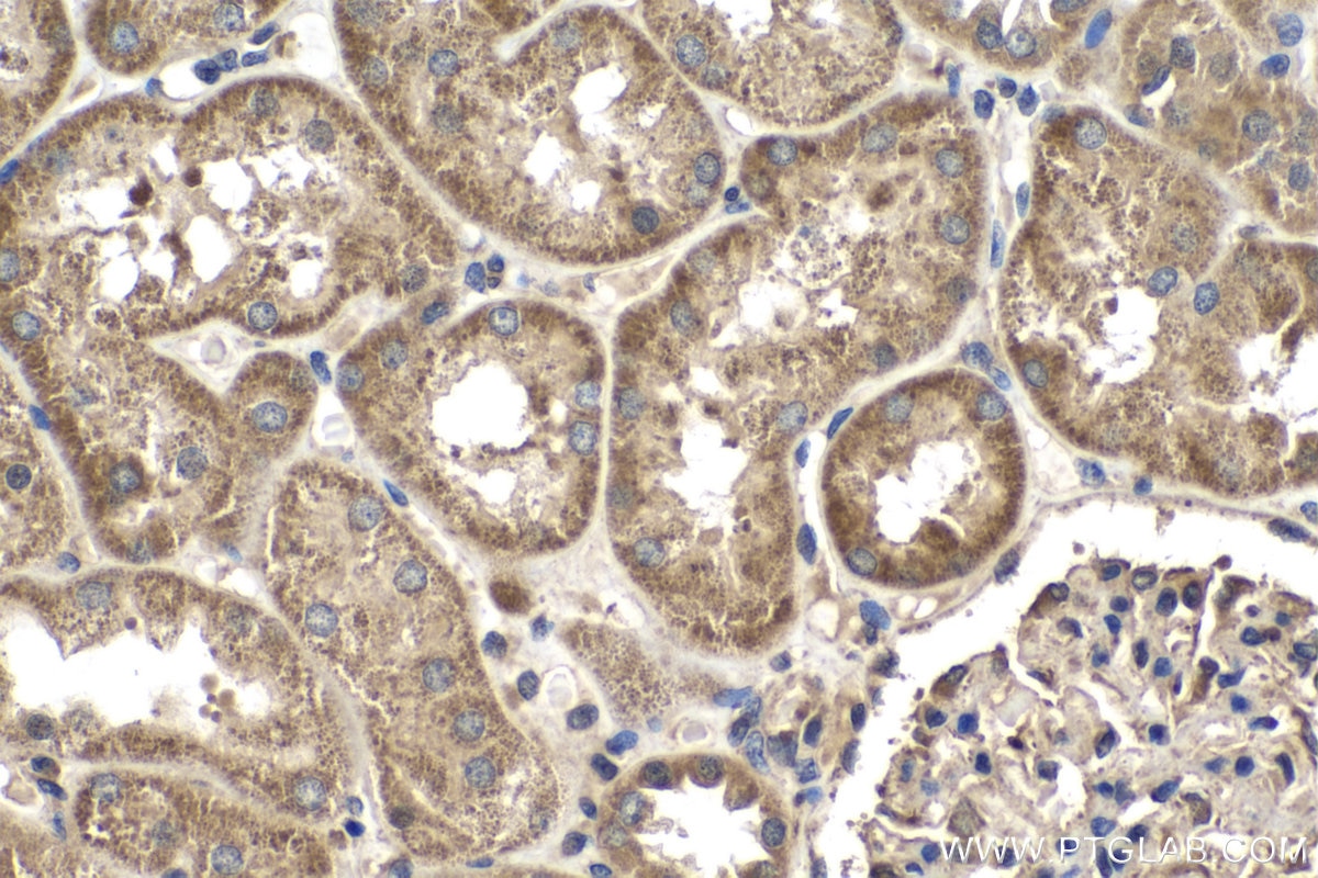 Immunohistochemistry (IHC) staining of human kidney tissue using RSPO1 Polyclonal antibody (25348-1-AP)