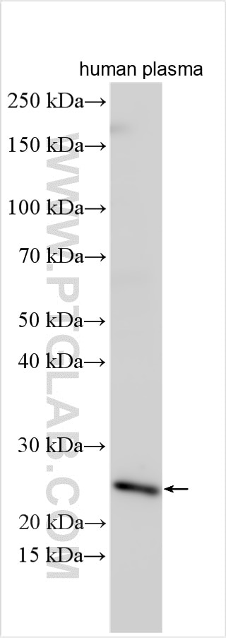 Western Blot (WB) analysis of human plasma using RSPO1 Polyclonal antibody (25348-1-AP)