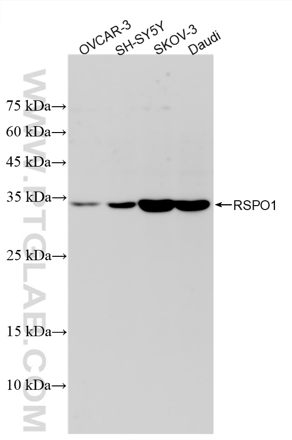 Western Blot (WB) analysis of various lysates using RSPO1 Recombinant monoclonal antibody (86039-2-RR)