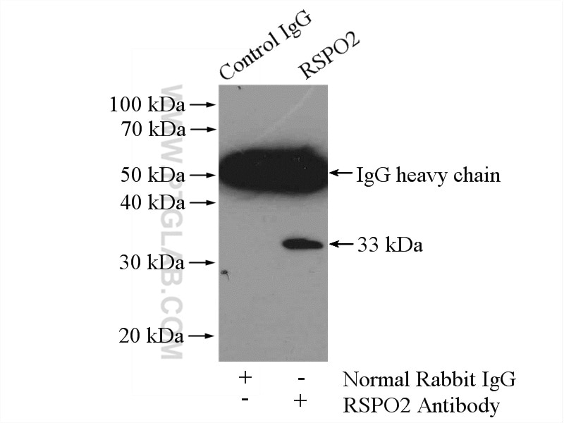 RSPO2 Polyclonal antibody