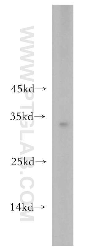 RSPO2 Polyclonal antibody