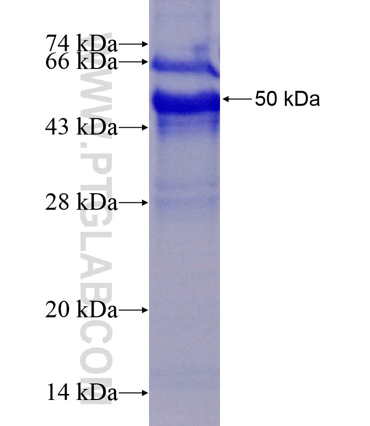 RSPO2 fusion protein Ag11041 SDS-PAGE