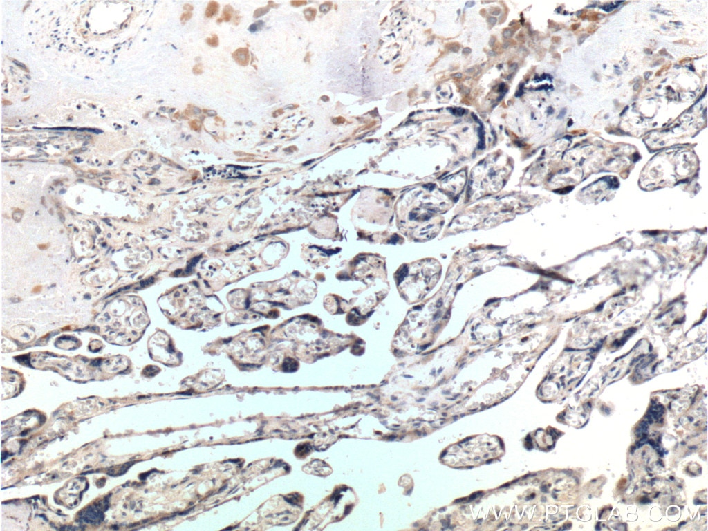 Immunohistochemistry (IHC) staining of human placenta tissue using RSPO3 Polyclonal antibody (17193-1-AP)