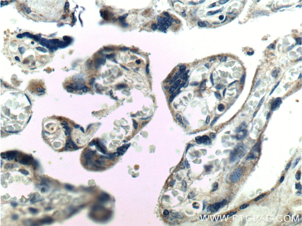 Immunohistochemistry (IHC) staining of human placenta tissue using RSPO3 Polyclonal antibody (17193-1-AP)