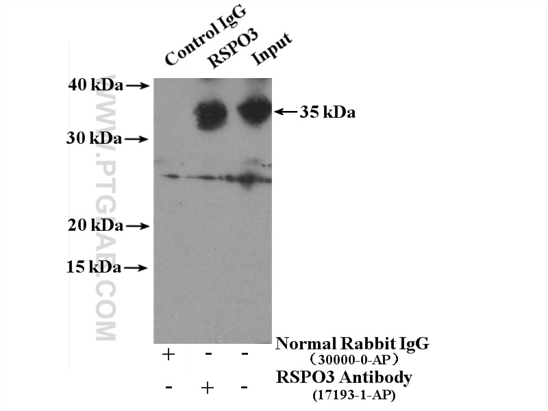 Immunoprecipitation (IP) experiment of human placenta tissue using RSPO3 Polyclonal antibody (17193-1-AP)