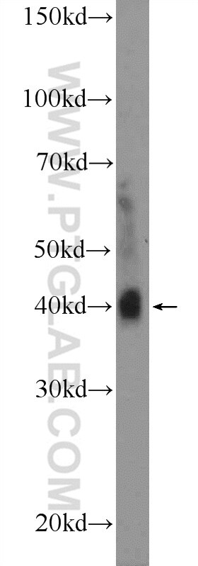 Western Blot (WB) analysis of mouse brain tissue using RSPO3 Polyclonal antibody (17193-1-AP)