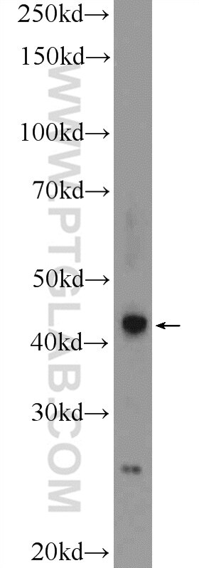 Western Blot (WB) analysis of A549 cells using RSPO3 Polyclonal antibody (17193-1-AP)