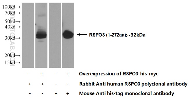 Western Blot (WB) analysis of Transfected HEK-293 cells using RSPO3 Polyclonal antibody (17193-1-AP)