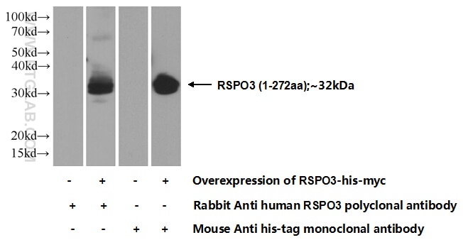 WB analysis of Transfected HEK-293 using 17193-1-AP