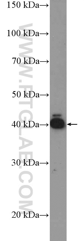 Western Blot (WB) analysis of human placenta tissue using RSPO3 Polyclonal antibody (17193-1-AP)