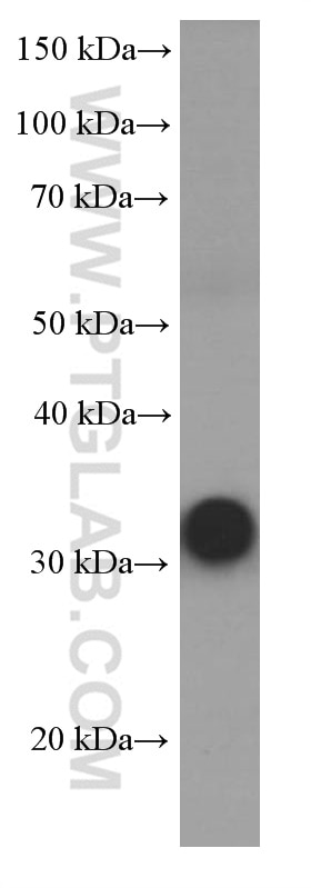 Western Blot (WB) analysis of human skeletal muscle tissue using RSPO3 Monoclonal antibody (66314-1-Ig)