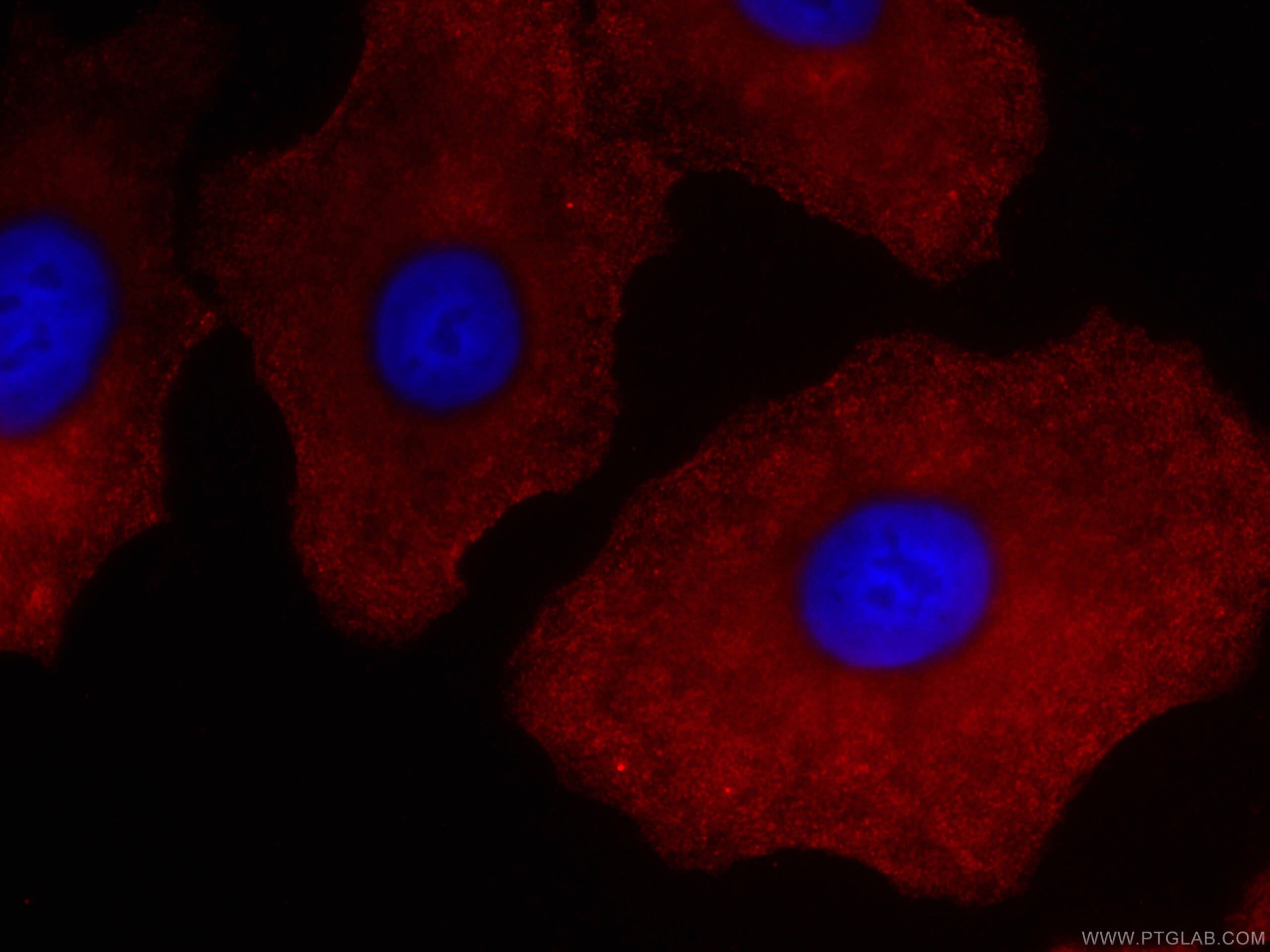 Immunofluorescence (IF) / fluorescent staining of A549 cells using CoraLite®594-conjugated RSPO3 Monoclonal antibody (CL594-66314)