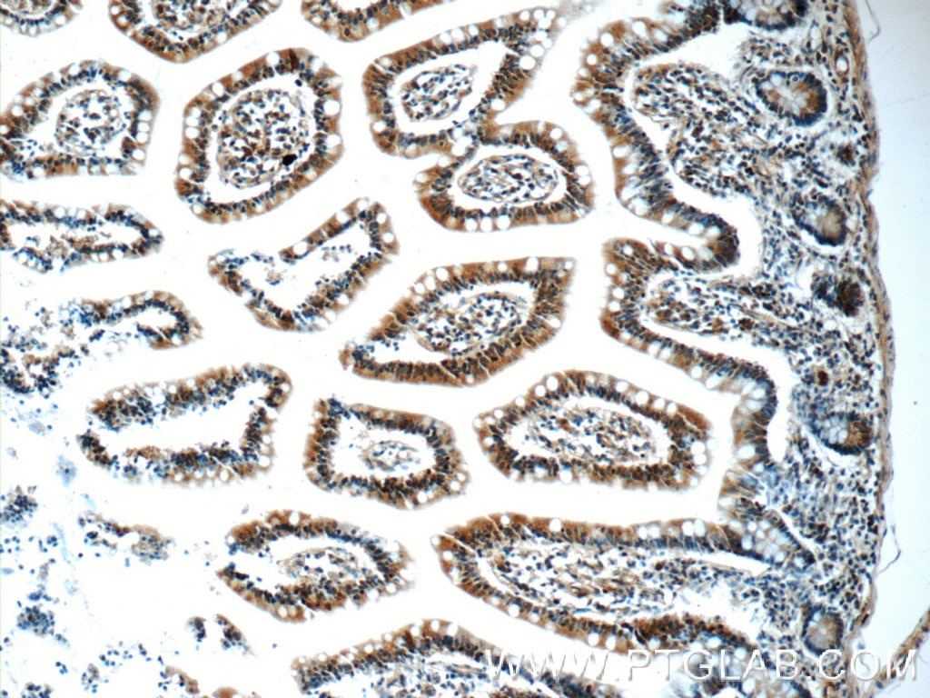 Immunohistochemistry (IHC) staining of human small intestine tissue using RSRC1 Polyclonal antibody (23826-1-AP)