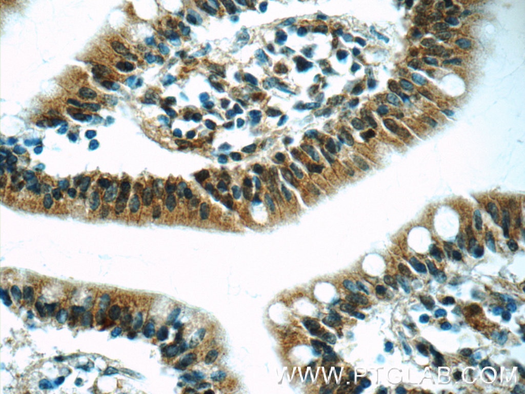Immunohistochemistry (IHC) staining of human small intestine tissue using RSRC1 Polyclonal antibody (23826-1-AP)