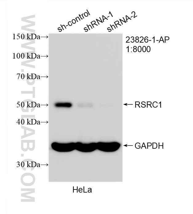 Western Blot (WB) analysis of HeLa cells using RSRC1 Polyclonal antibody (23826-1-AP)