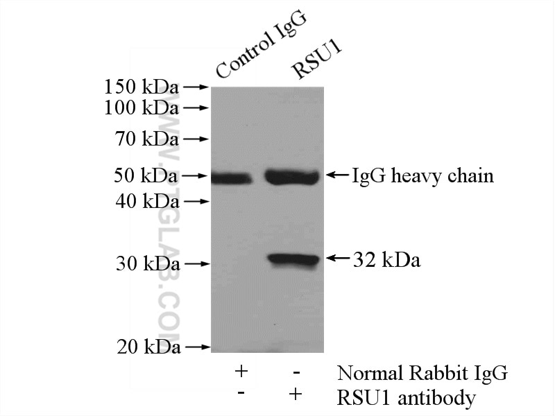 Immunoprecipitation (IP) experiment of human placenta tissue using RSU1 Polyclonal antibody (11207-1-AP)