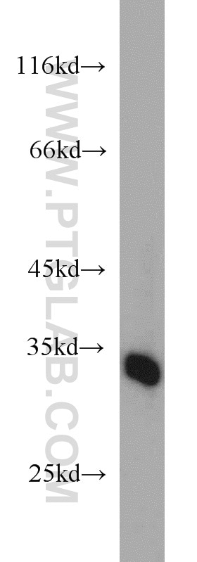 Western Blot (WB) analysis of human bladder tissue using RSU1 Polyclonal antibody (11207-1-AP)