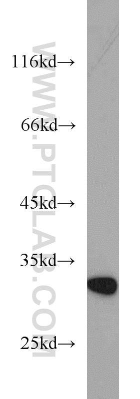 Western Blot (WB) analysis of mouse placenta tissue using RSU1 Polyclonal antibody (11207-1-AP)