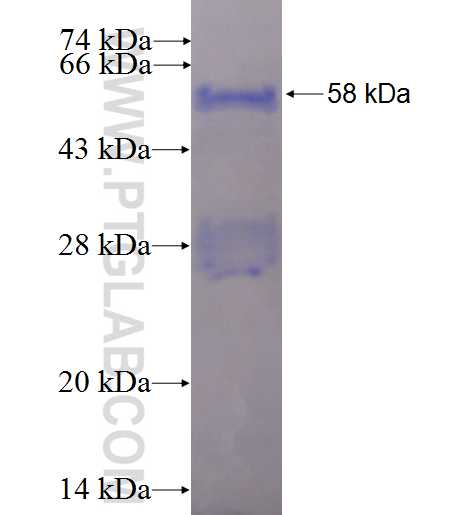 RSU1 fusion protein Ag1693 SDS-PAGE