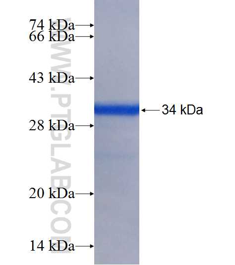 RTBDN fusion protein Ag8155 SDS-PAGE