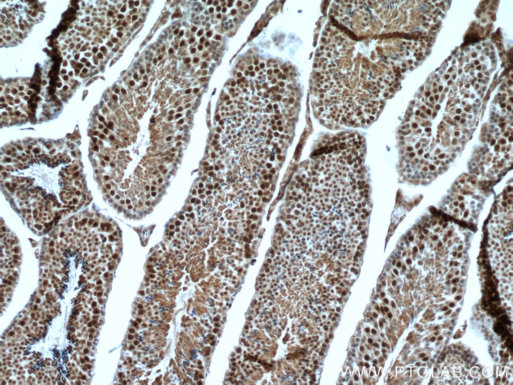 Immunohistochemistry (IHC) staining of mouse testis tissue using RTCD1 Polyclonal antibody (15996-1-AP)