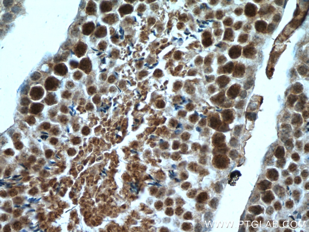 Immunohistochemistry (IHC) staining of mouse testis tissue using RTCD1 Polyclonal antibody (15996-1-AP)