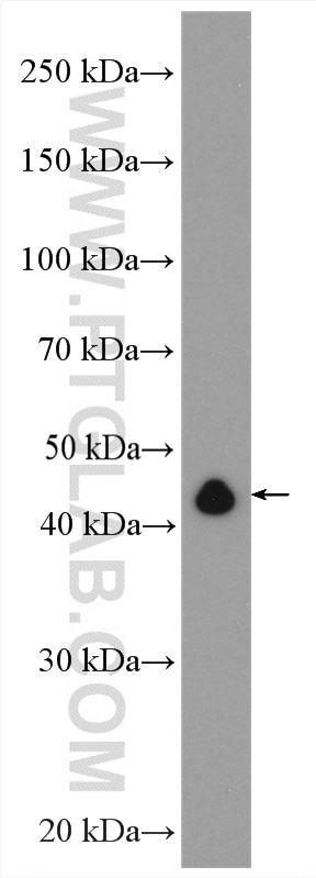 Western Blot (WB) analysis of Jurkat cells using RTCD1 Polyclonal antibody (15996-1-AP)