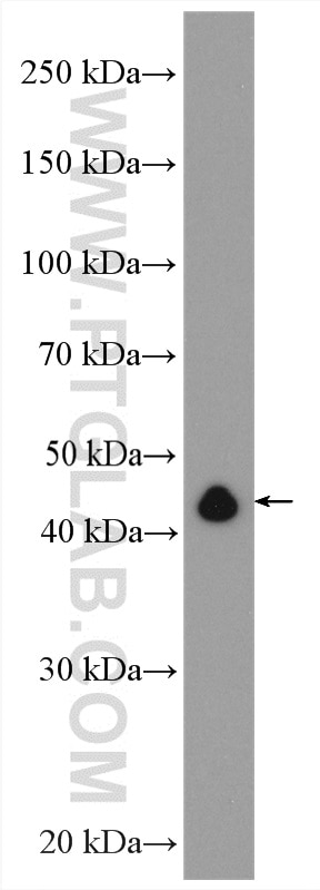 WB analysis of Jurkat using 15996-1-AP