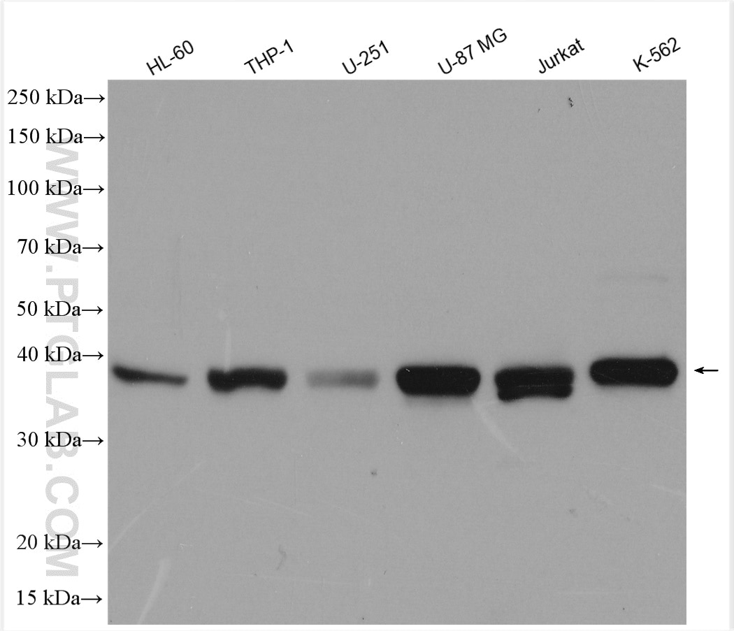 Western Blot (WB) analysis of various lysates using RTCD1 Polyclonal antibody (15996-1-AP)