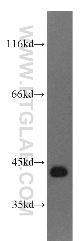 WB analysis of K-562 using 15996-1-AP