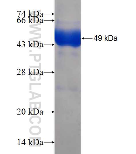 RTCD1 fusion protein Ag9304 SDS-PAGE