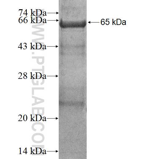 RTDR1 fusion protein Ag2616 SDS-PAGE