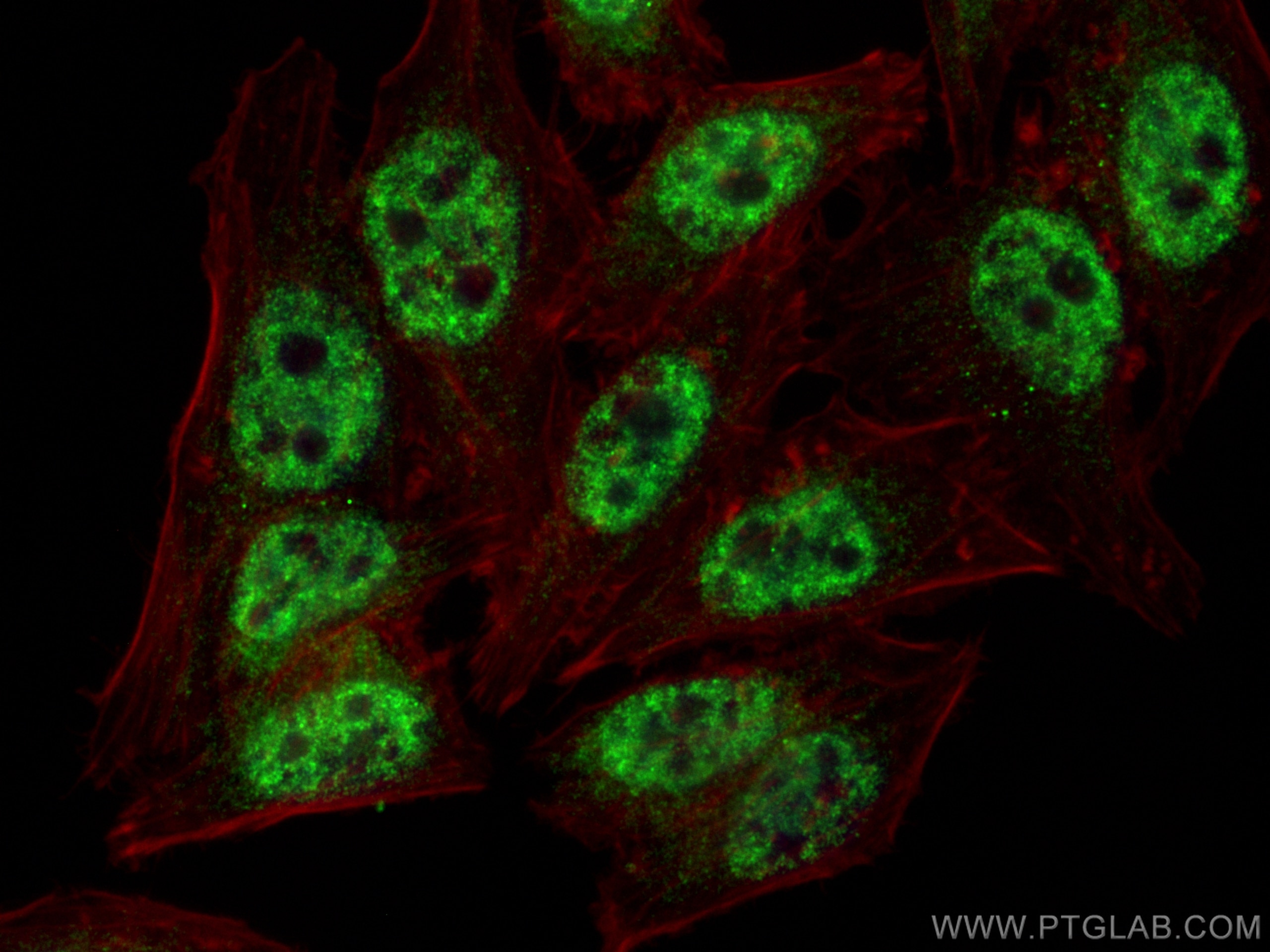 Immunofluorescence (IF) / fluorescent staining of HepG2 cells using RTEL1 Polyclonal antibody (25337-1-AP)