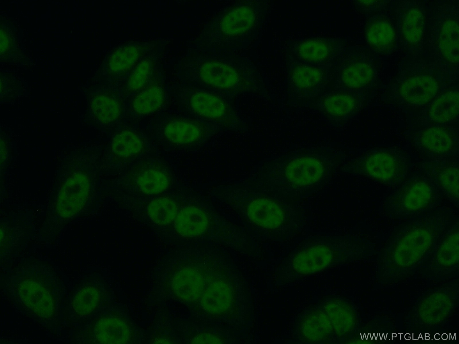 Immunofluorescence (IF) / fluorescent staining of HepG2 cells using RTEL1 Polyclonal antibody (25337-1-AP)