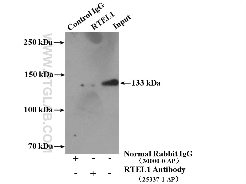 Immunoprecipitation (IP) experiment of mouse brain tissue using RTEL1 Polyclonal antibody (25337-1-AP)