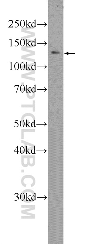 Western Blot (WB) analysis of C6 cells using RTEL1 Polyclonal antibody (25337-1-AP)