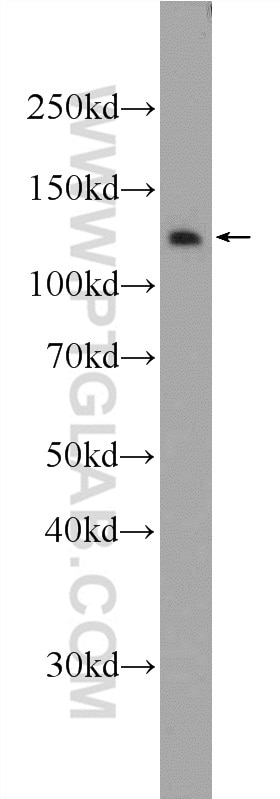 WB analysis of HeLa using 25337-1-AP