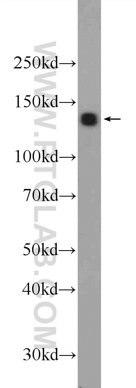 Western Blot (WB) analysis of mouse brain tissue using RTEL1 Polyclonal antibody (25337-1-AP)