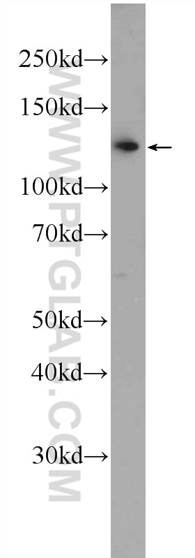 Western Blot (WB) analysis of PC-3 cells using RTEL1 Polyclonal antibody (25337-1-AP)